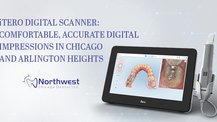 iTero Digital Scanner