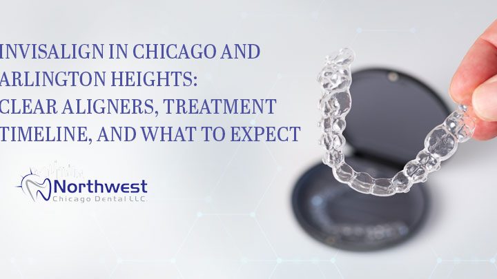 invisalign northwest chicago dental